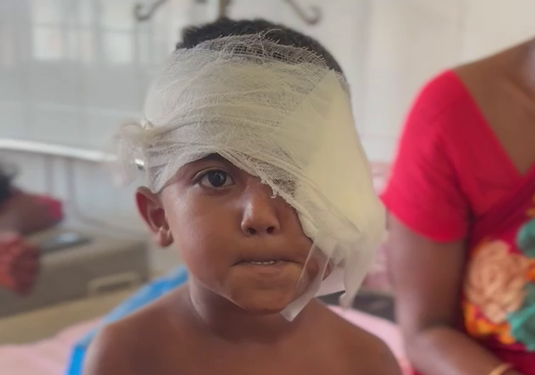 Help 5 Years Old Rinku See the World Again